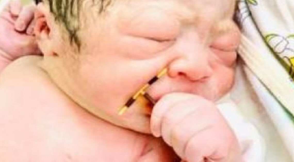 Táto fotografia novorodenca, ktorý drží vnútromaternicové teliesko, vyvolala senzáciu po celom svete!