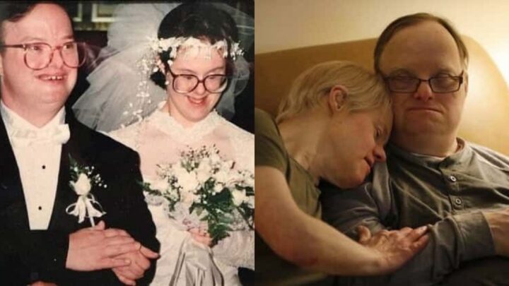 Downov syndróm im nezabránil prežiť 25 nádherných rokov manželstva a rozdelila ich len smrť…