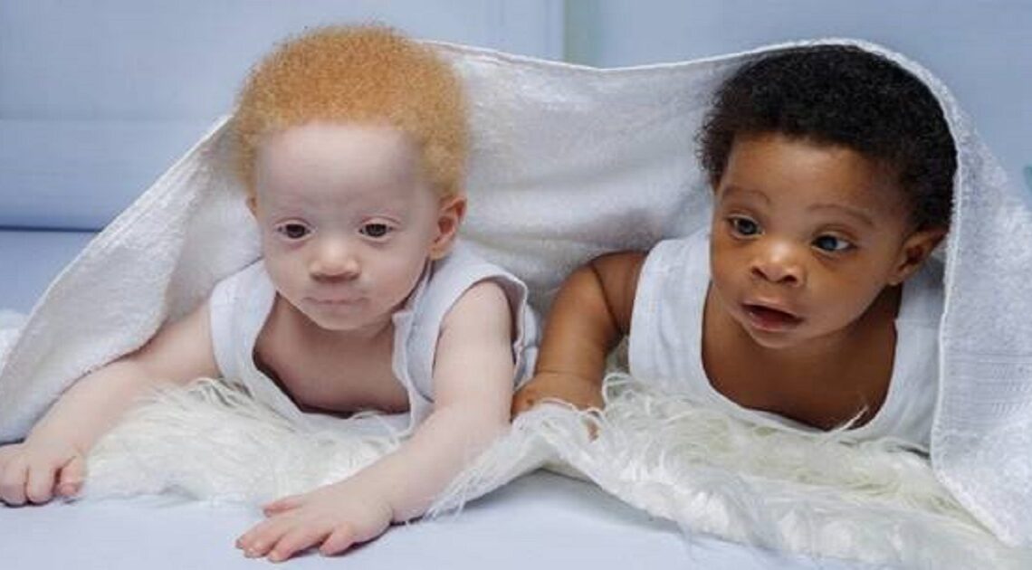 Nigérijskému páru sa narodili veľmi odlišné dvojčatá. Keď otec zistil dôvod, takmer ochorel.
