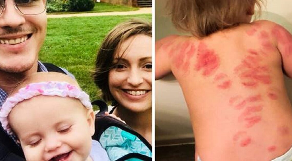 Vzala dcéru zo škôlky domov a takto vyzeral jej chrbát!