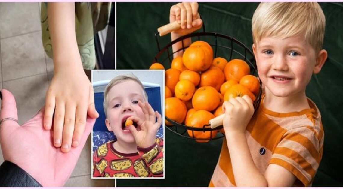 Chlapcovi sa zmení farba pokožky vždy, keď zje pomaranče. Je to zvláštny prípad…