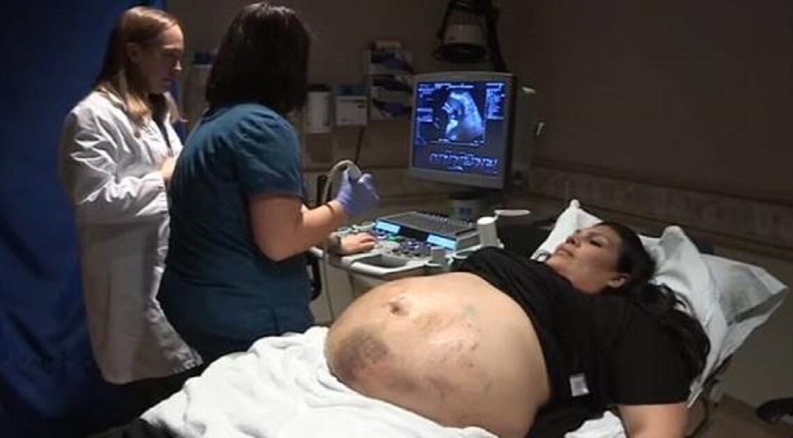 Bruško tehotnej matky bolo plné modrín. Toto si lekári všimli počas ultrazvukového vyšetrenia!