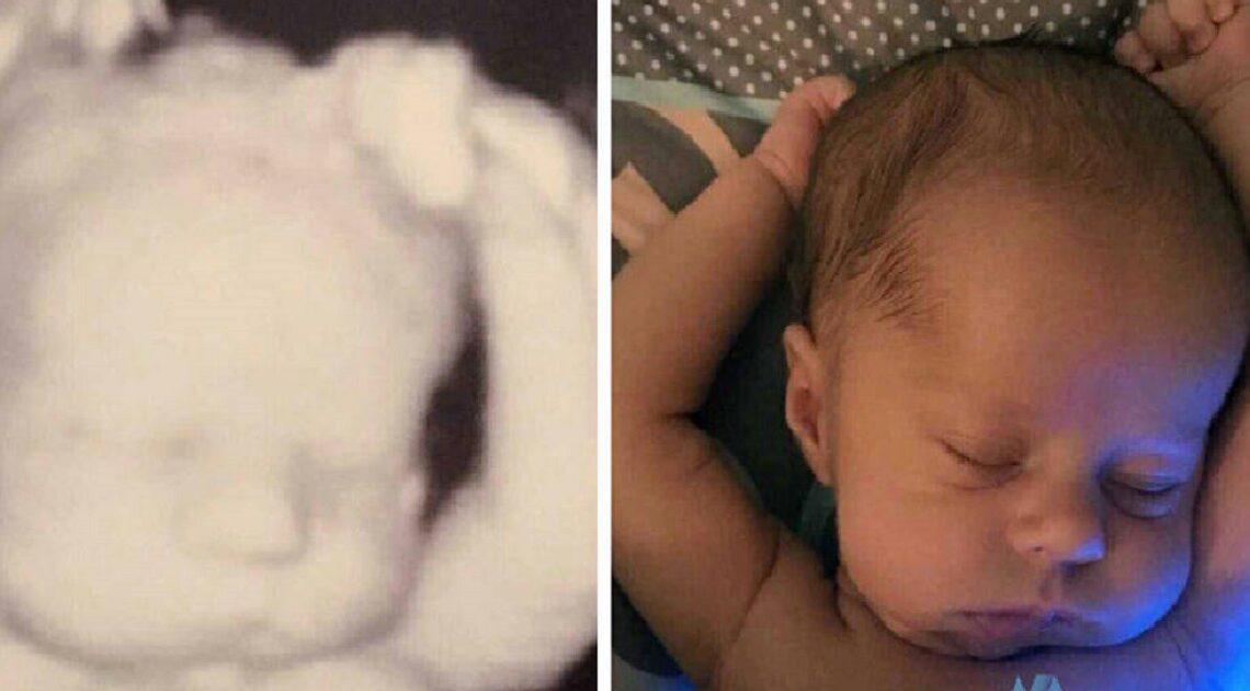 Týždne po pôrode matka porovnáva ultrazvukový obraz so svojím dieťaťom: Nádherné!