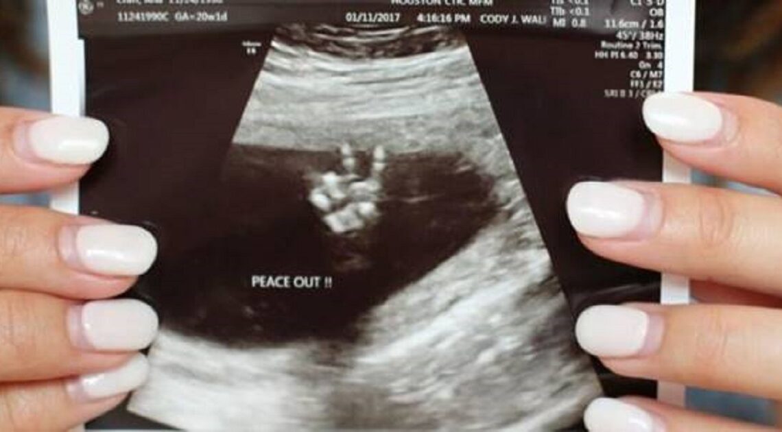 Matka išla na svoj prvý ultrazvuk a jej dieťa ju naozaj rozosmialo. Toto videli na ultrazvuku!