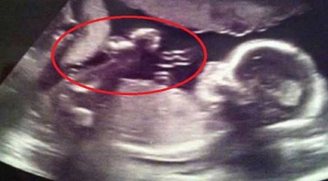 Išli na ultrazvuk, ale úsmev na tvári im zamrzol z toho, čo videli!