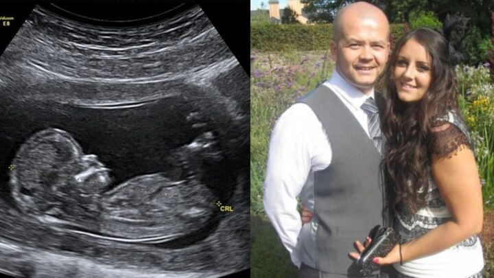 10 dní po potrate som išla na testy, akonáhle lekár videl ultrazvuk, stratil reč!